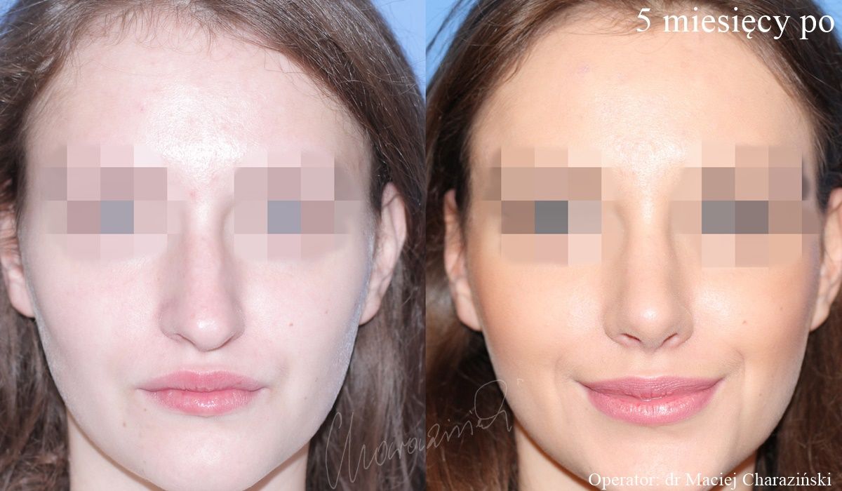 Maciej Charaziński-73