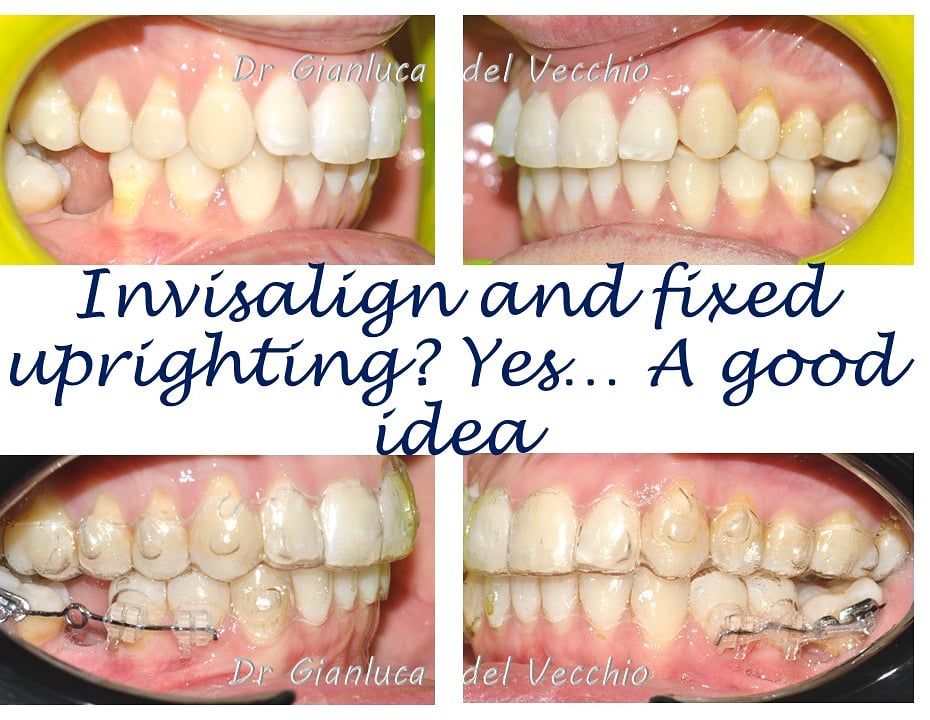 Gianluca Del Vecchio-67