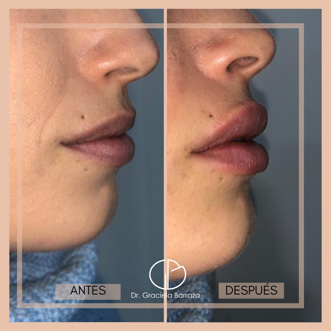 Graciela Barraza Jiménez-14