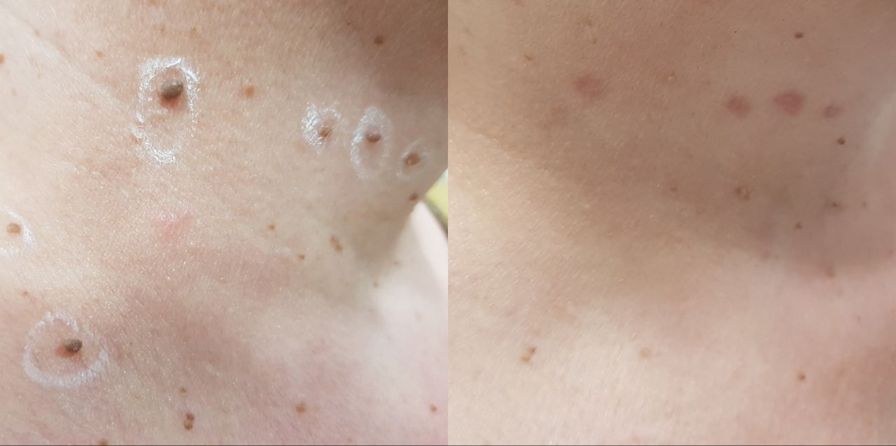 Rosalba Herrero Zerpa-219