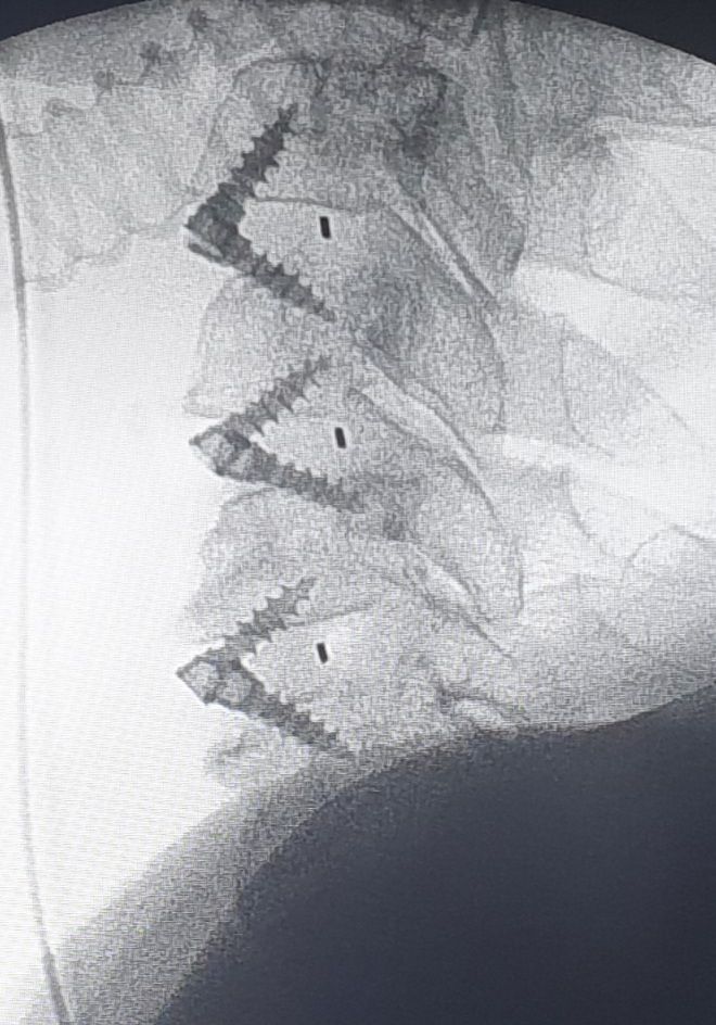 Alessandro Borderi-21