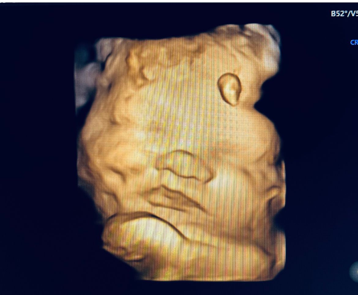 Magdalena Ziętara-5