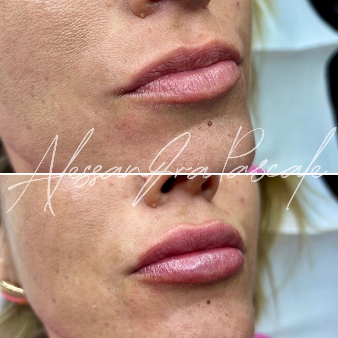 Alessandra Pascale-16