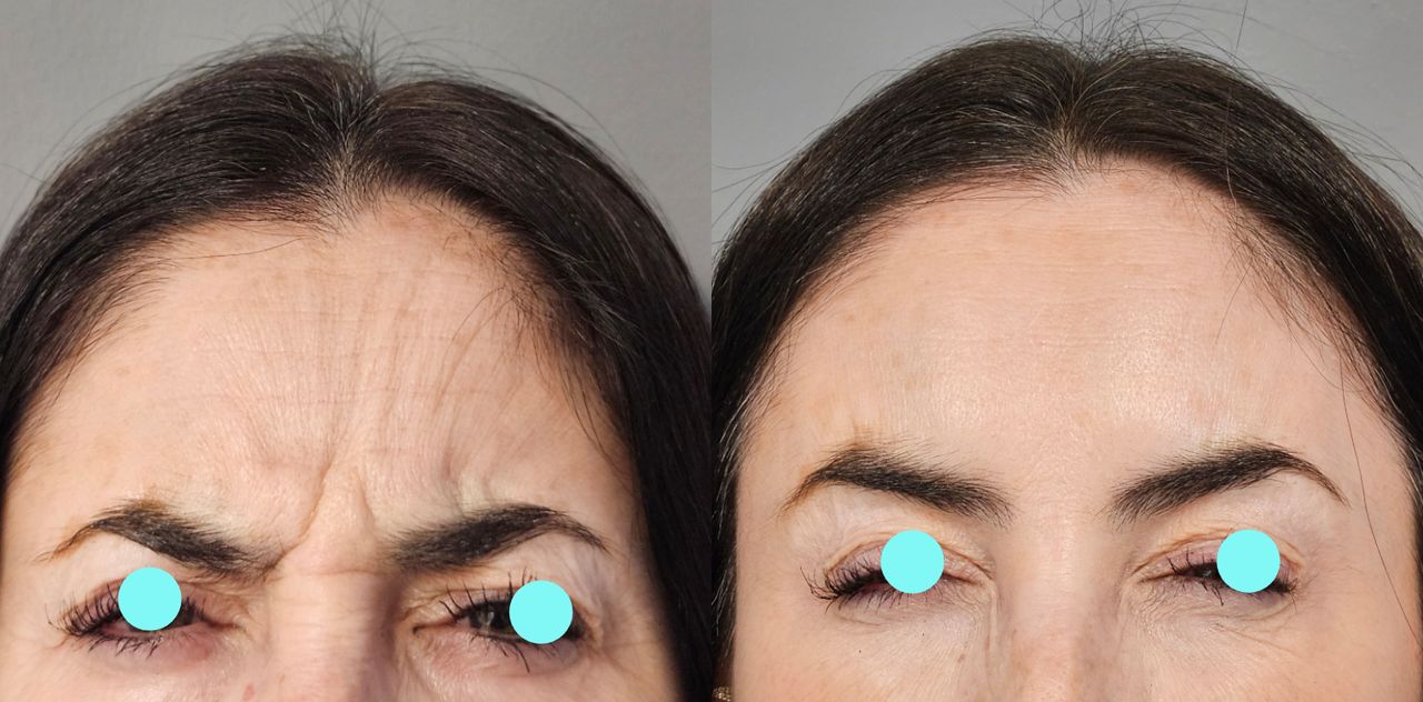 Rosalba Herrero Zerpa-443