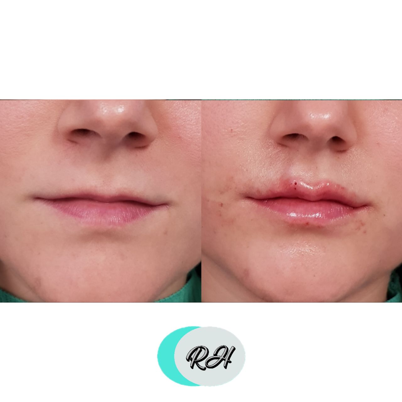 Rosalba Herrero Zerpa-94