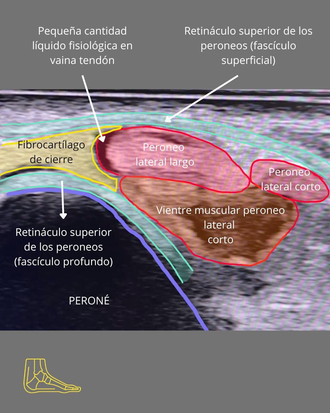 Didac Perez Valles-6