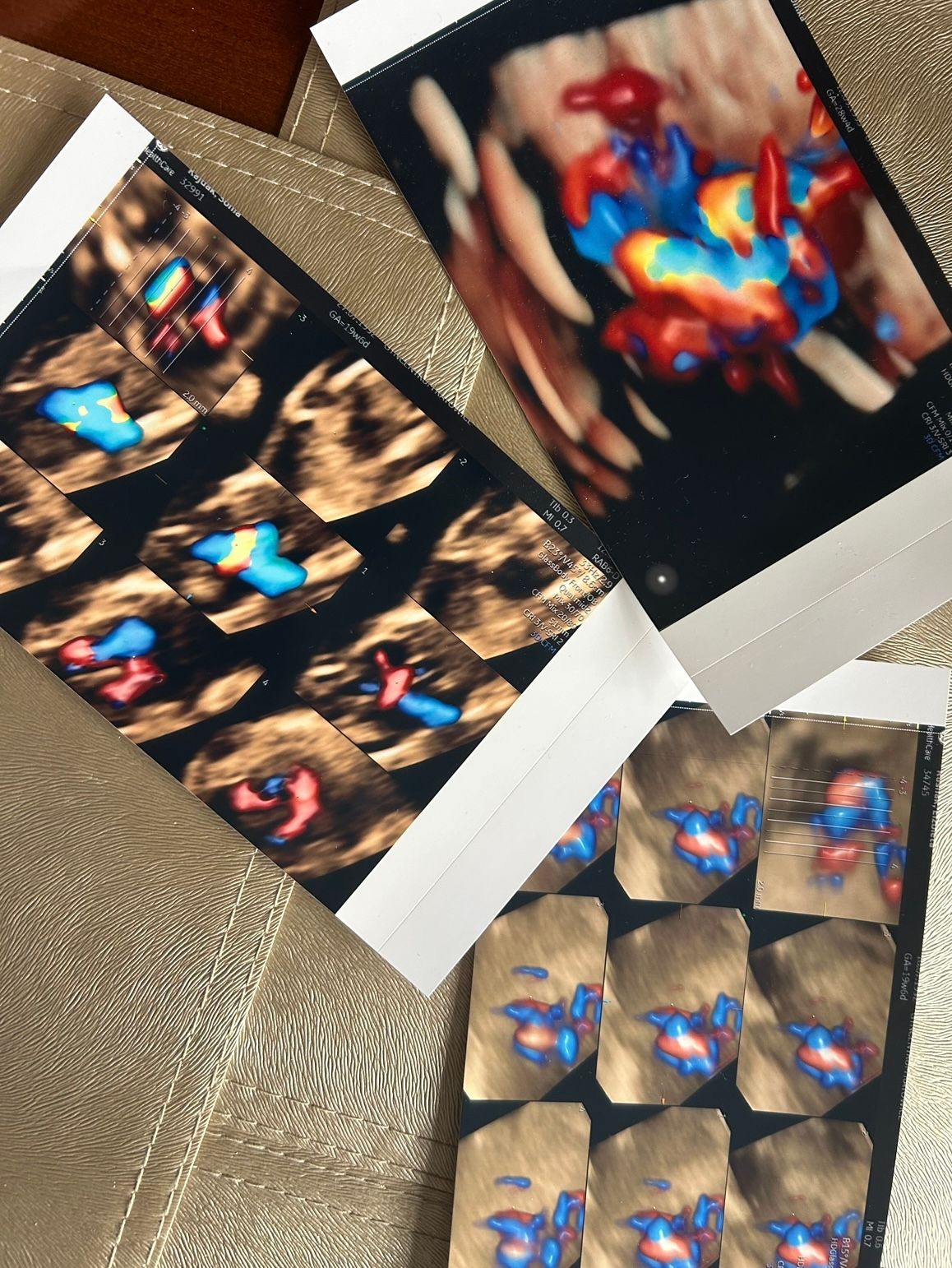 Wioletta Rozmus-Warcholińska-142