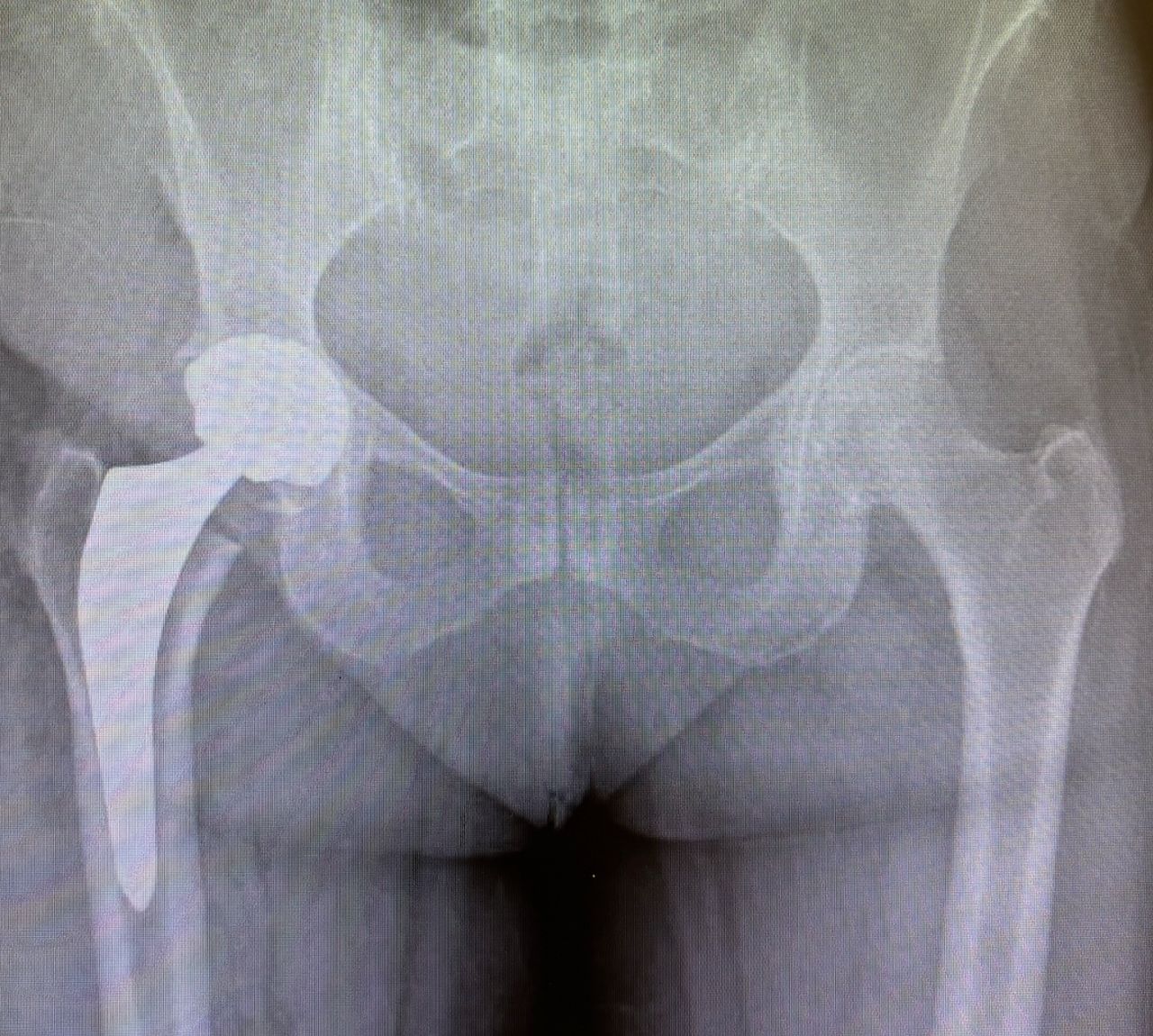 Alessandro Del Monaco-12