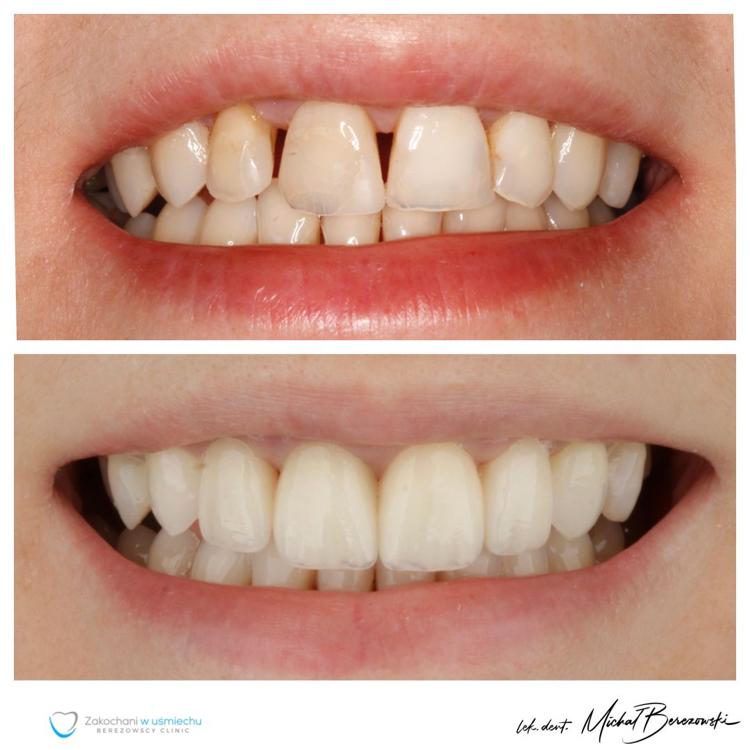 Michał Berezowski-12