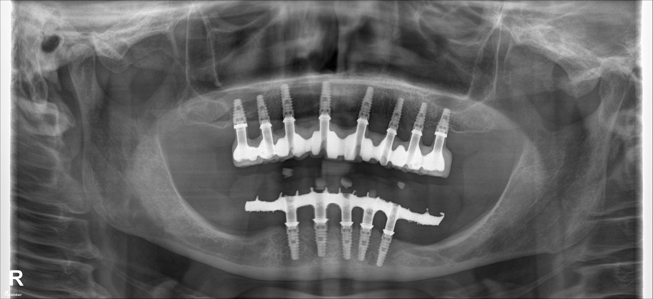 Ruben Patier Martin-38