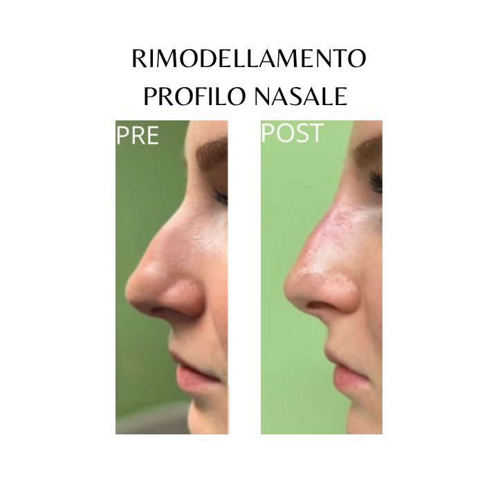 Giovanni Migliorini-9