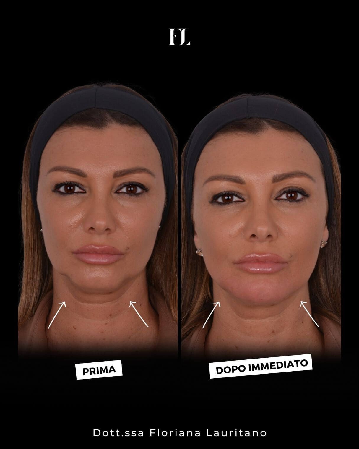 Floriana Lauritano-13