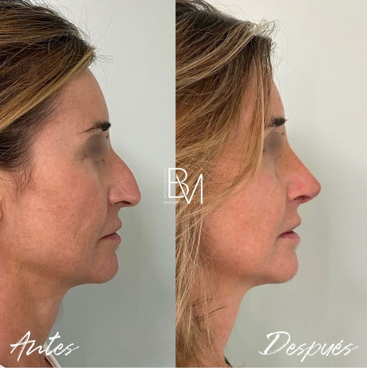 Beatriz Moralejo-57