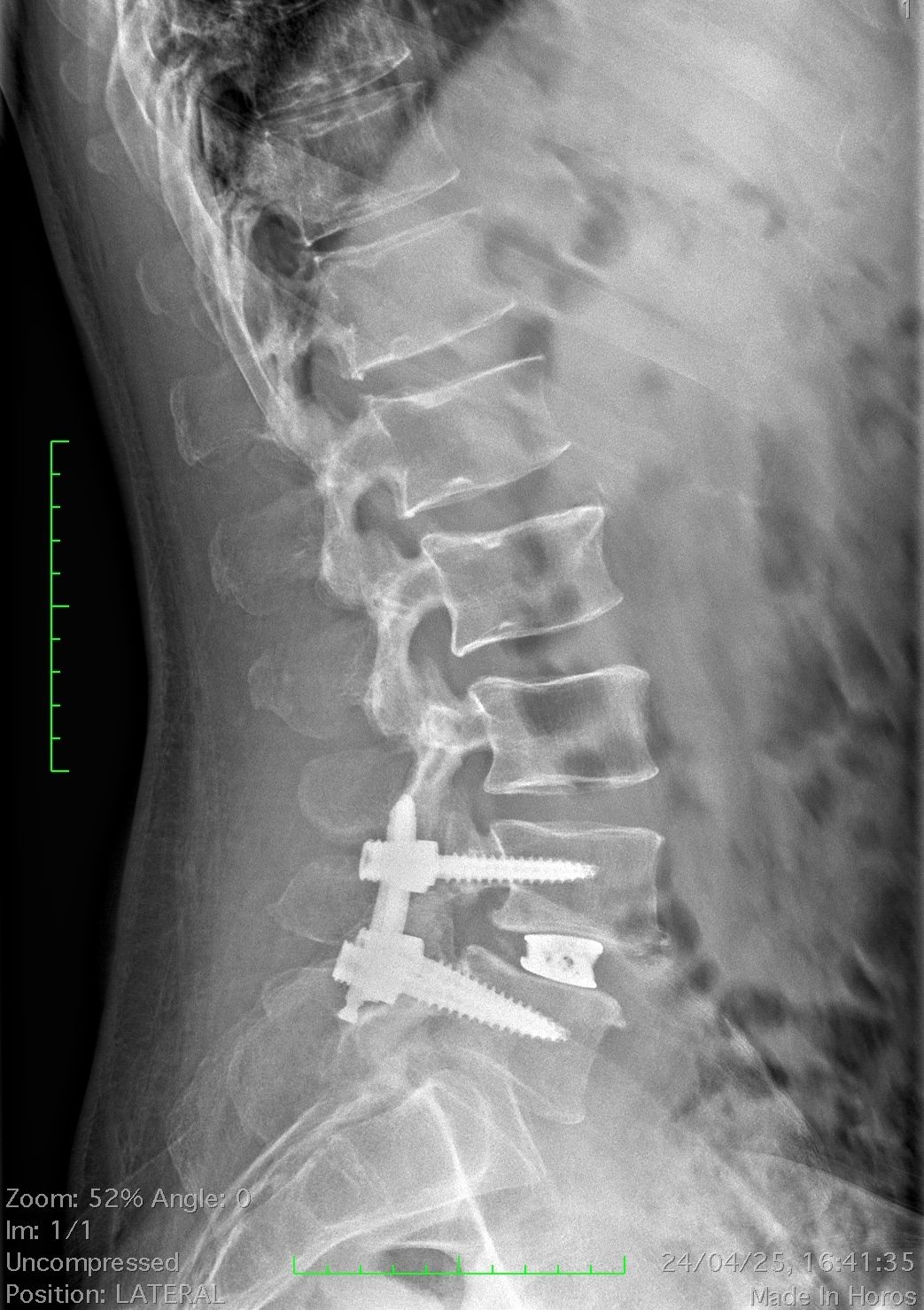 Francesco Natrella-6