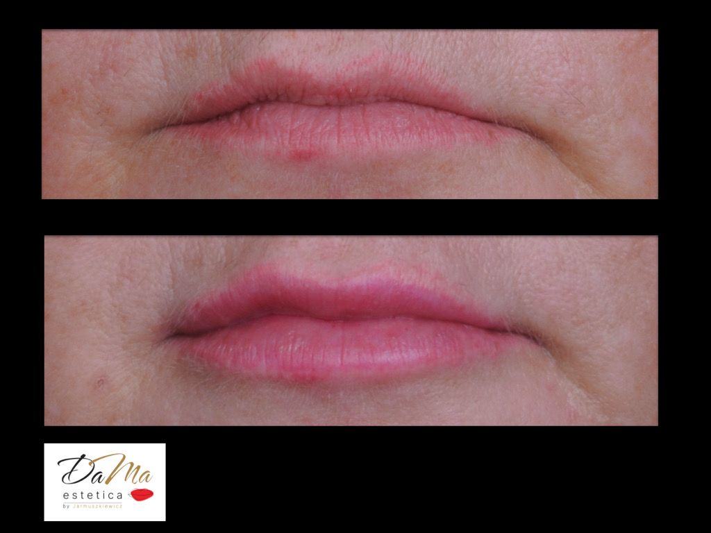 Dagmara Lisiak - Osuch-2