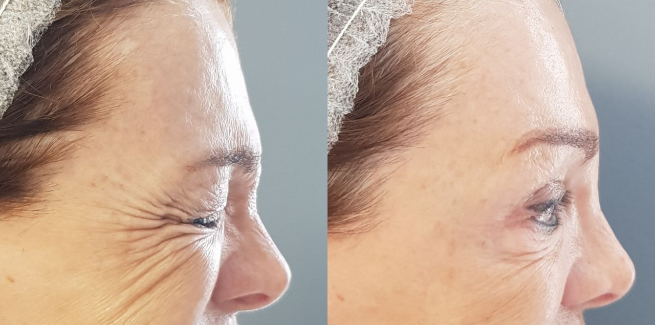 Rosalba Herrero Zerpa-498