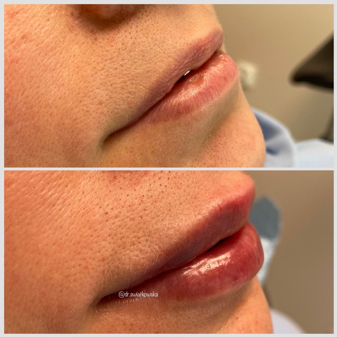 Angelika Świątkowska-39