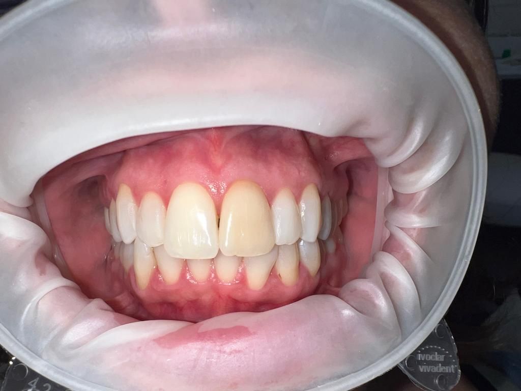 Giampiero Piccione-6