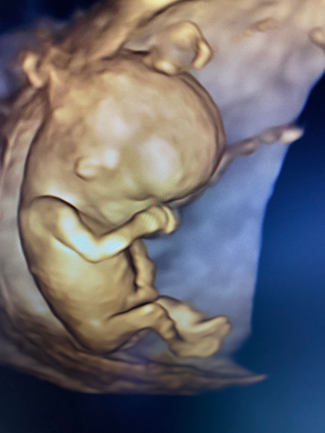 Karolina Panek - Laszczyńska-13