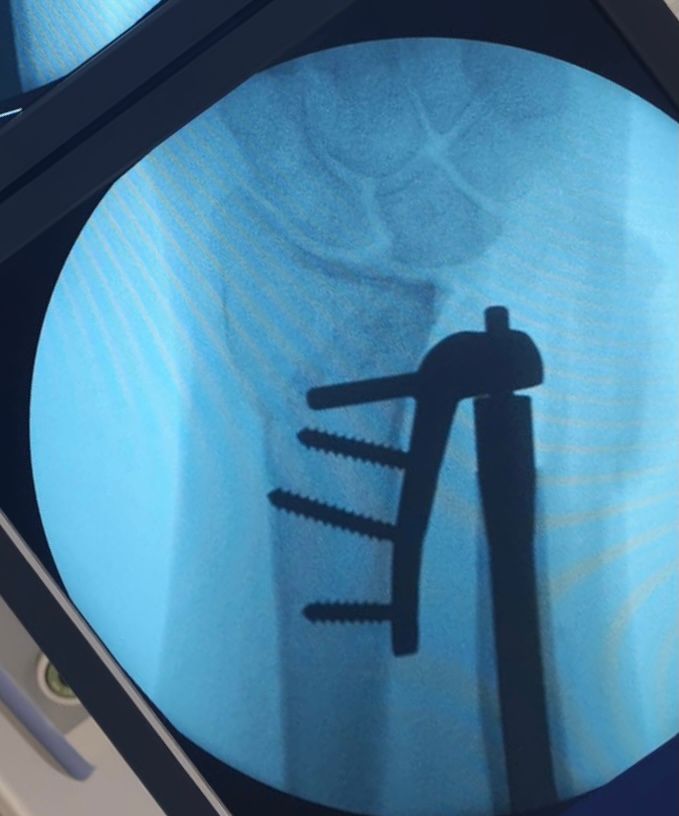 Jose Manuel Perez Alba-10