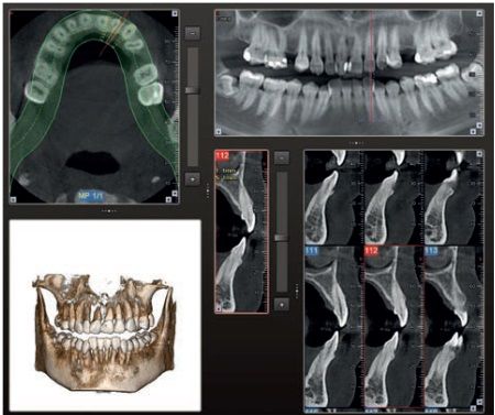 Lorenzo Paolo Bottini-10