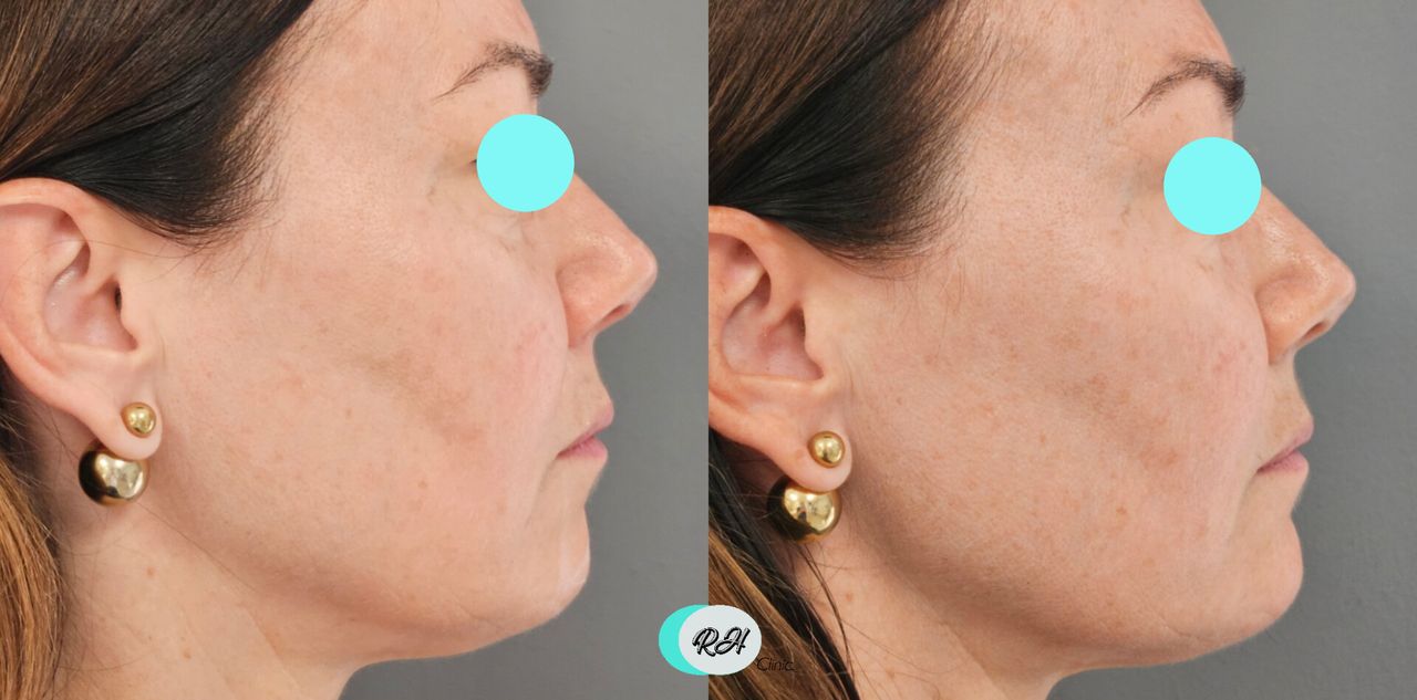 Rosalba Herrero Zerpa-610