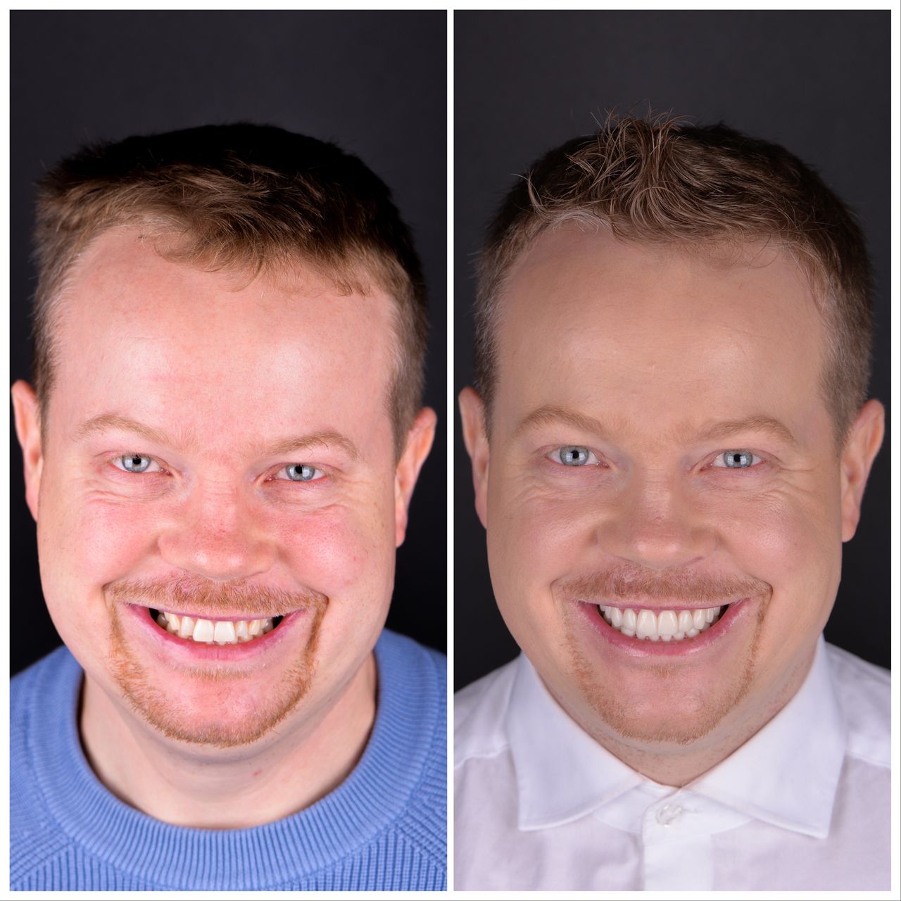 Martin Bartoszcze-27