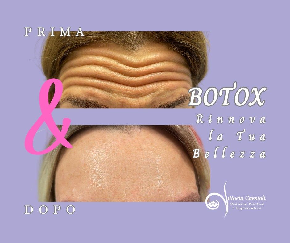 Vittoria Cassioli-54