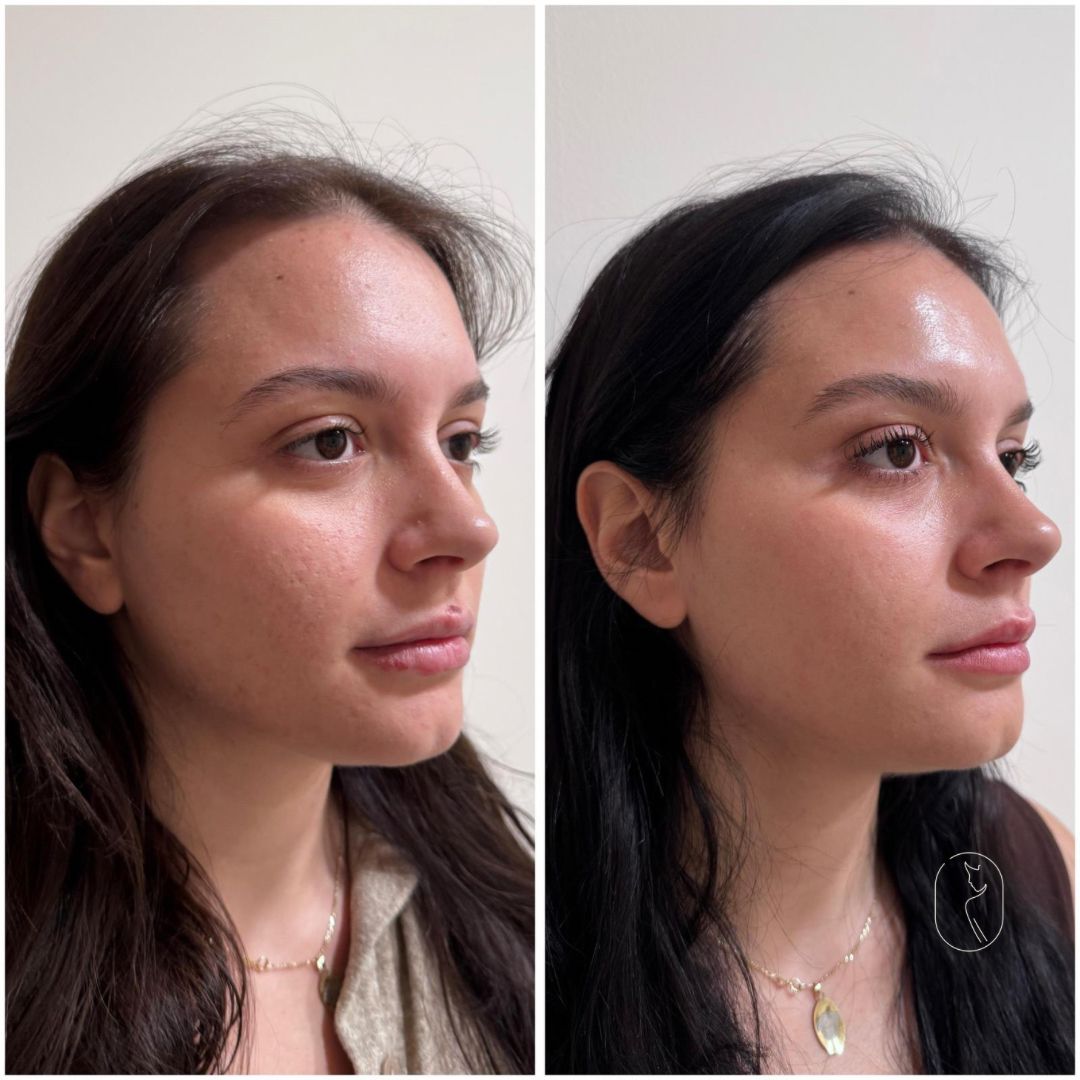 Clara Alonso Mompó-2