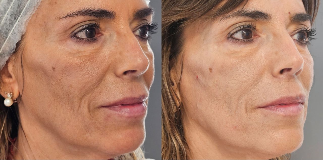 Rosalba Herrero Zerpa-36