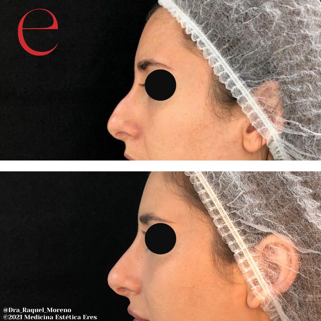 Raquel Moreno Pentinel-85