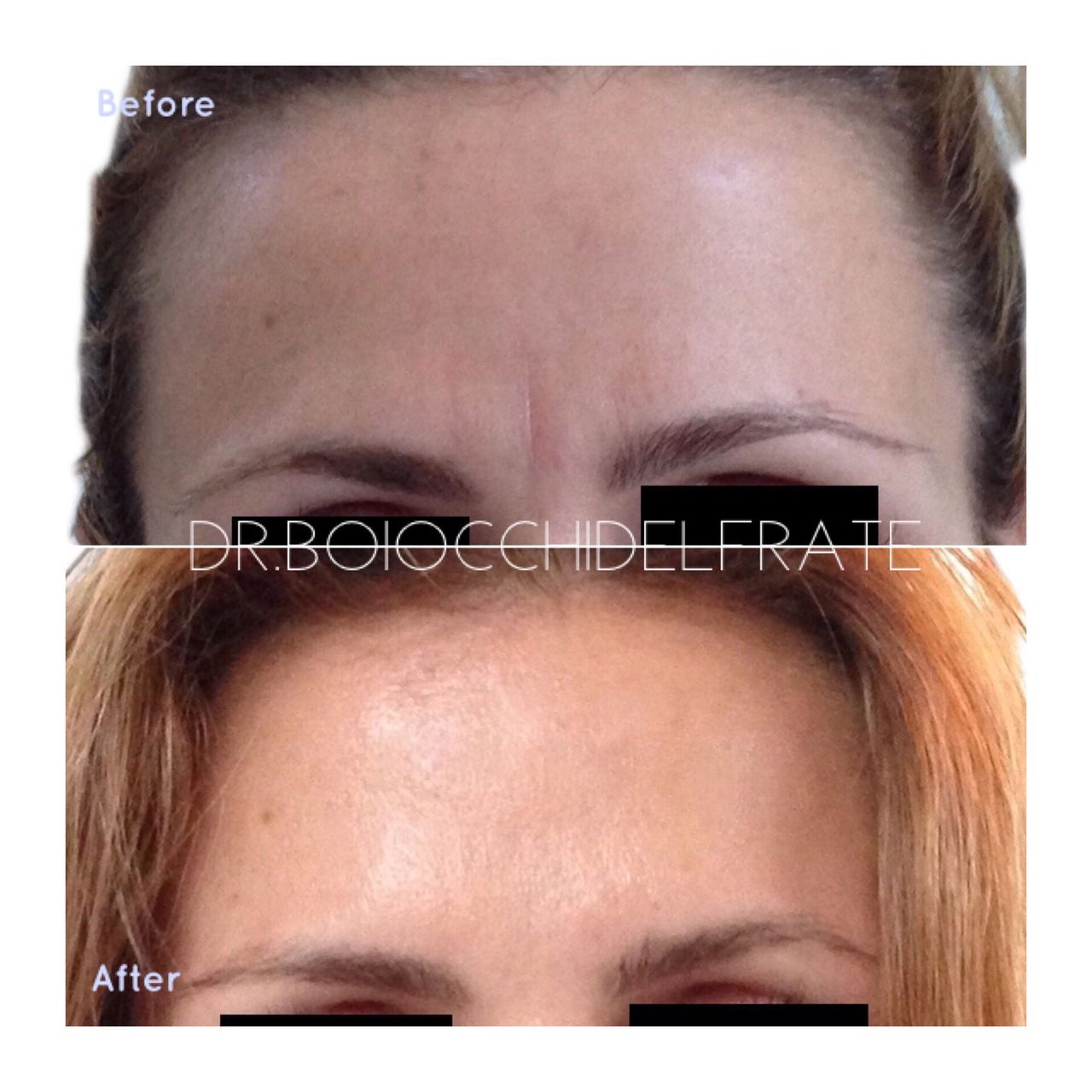 Marco Boiocchi Delfrate-2