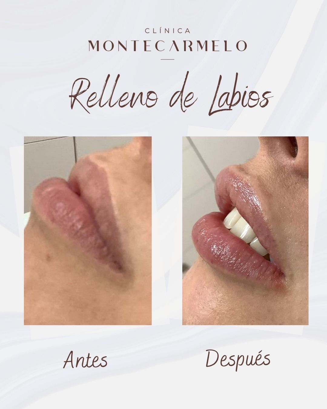 Carmen Martin Marcos-11