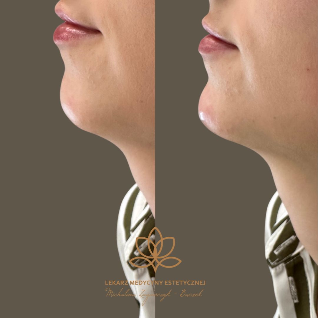 Michalina Zagańczyk-Bączek-21