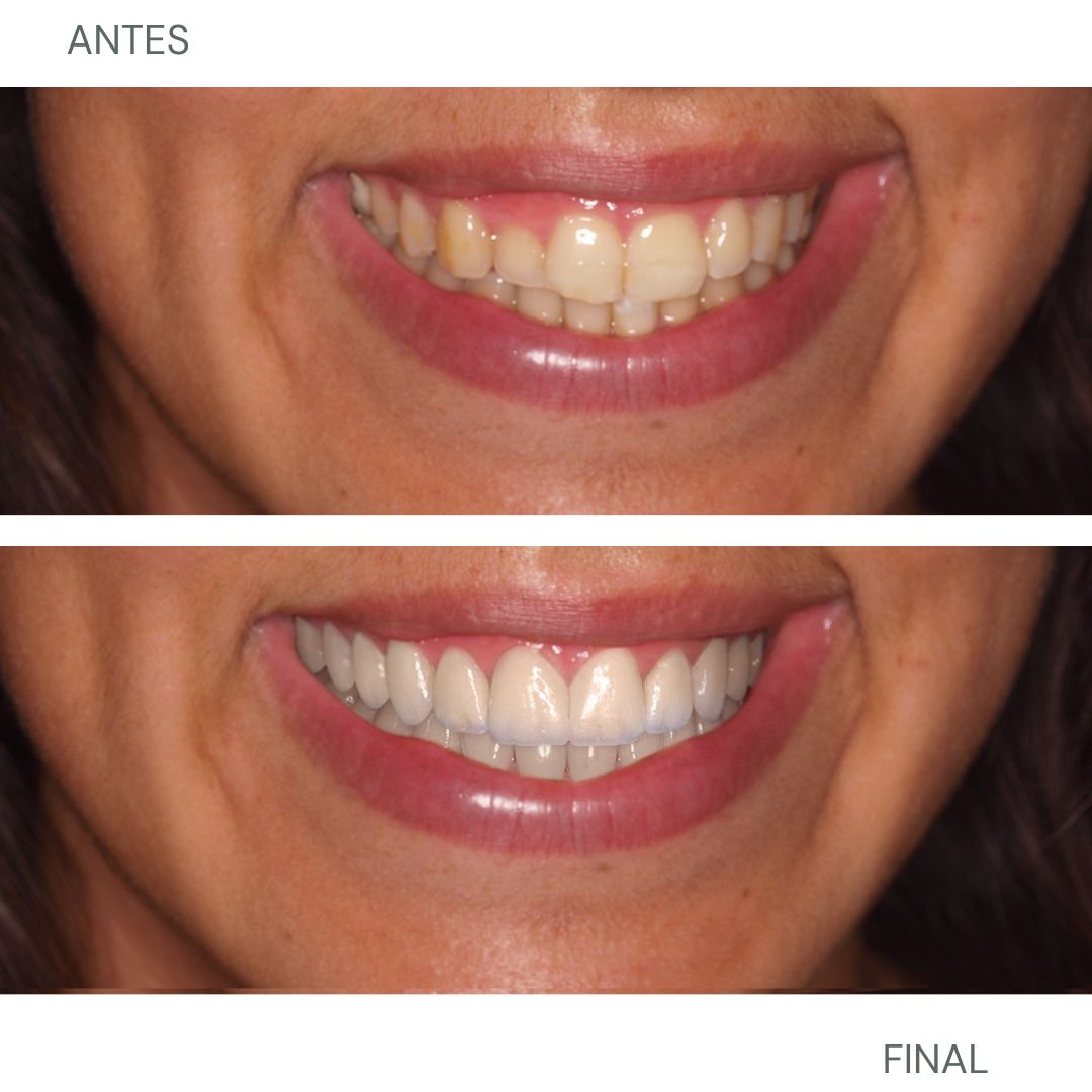 Marien Morata Roig-26