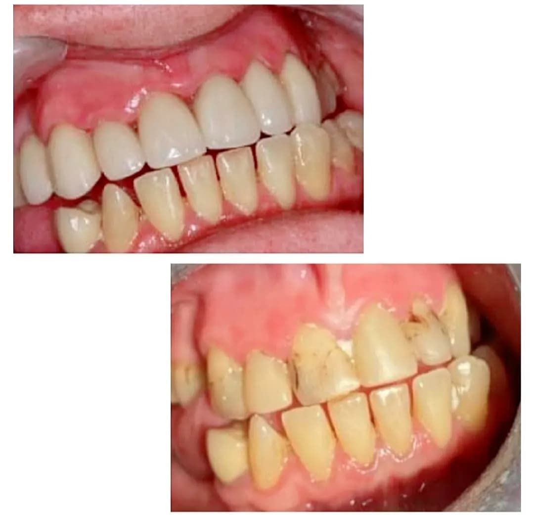 Michał Poterałowicz-3