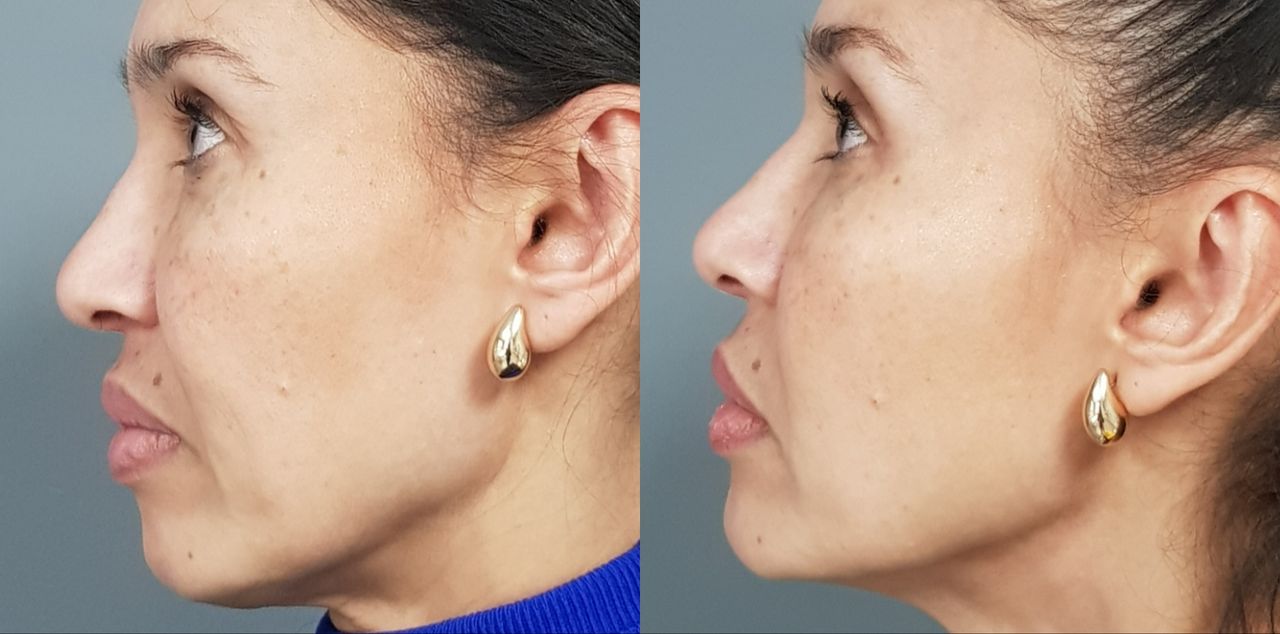 Rosalba Herrero Zerpa-482