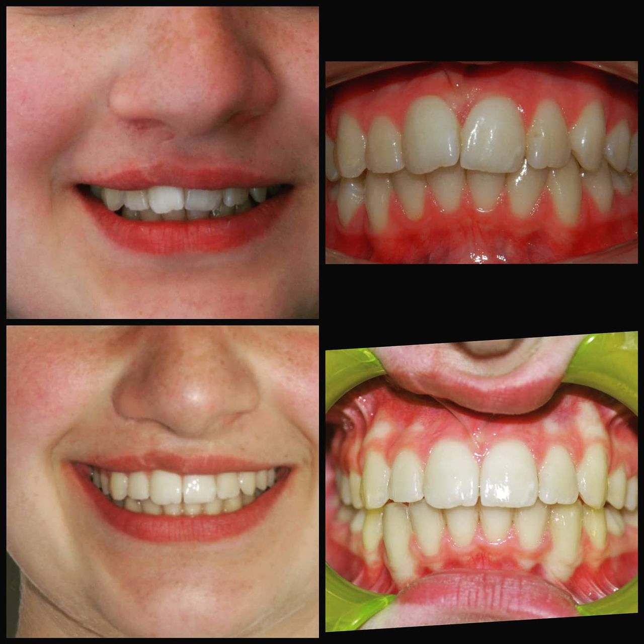 Gianluca Del Vecchio-37