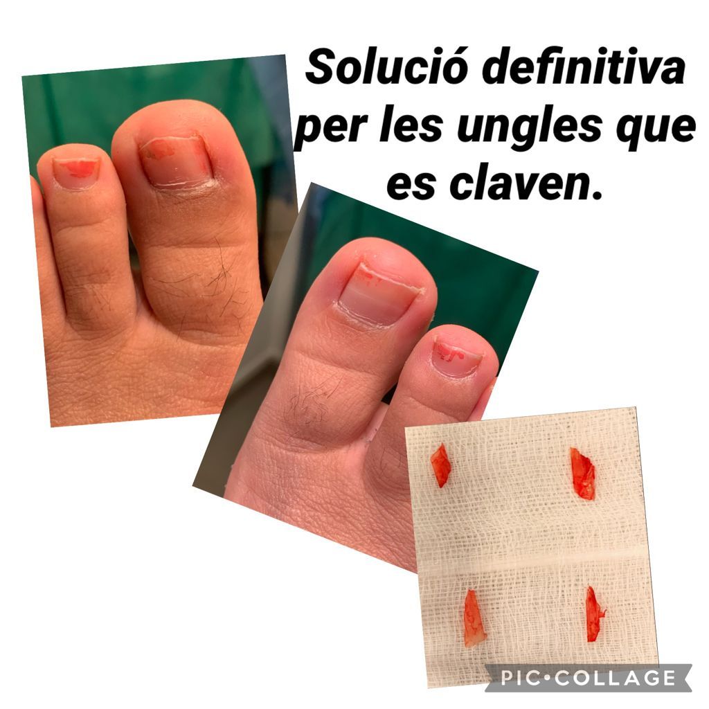 Mercè Garcia Lizandra-15