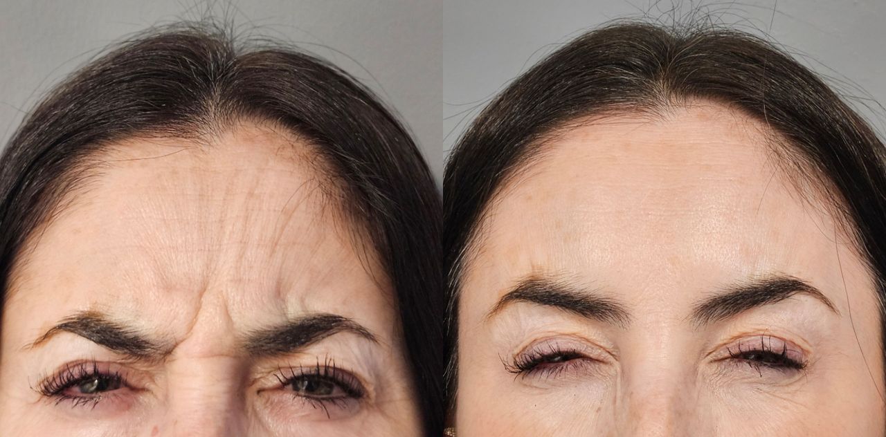 Rosalba Herrero Zerpa-25