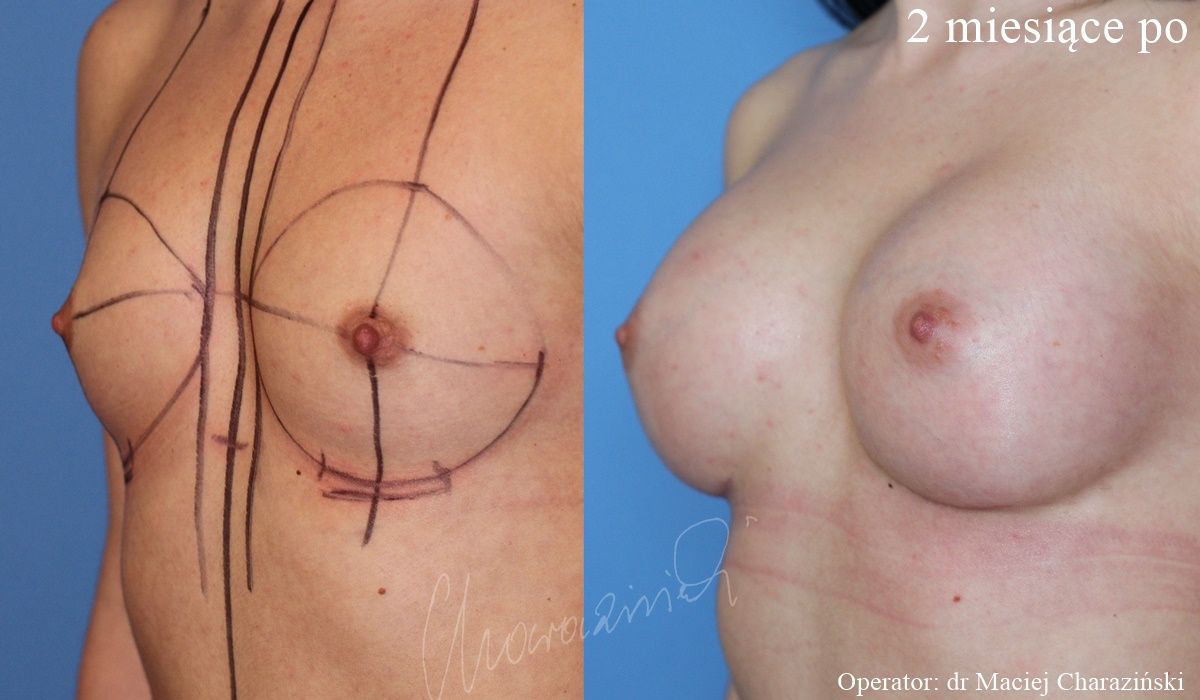 Maciej Charaziński-94