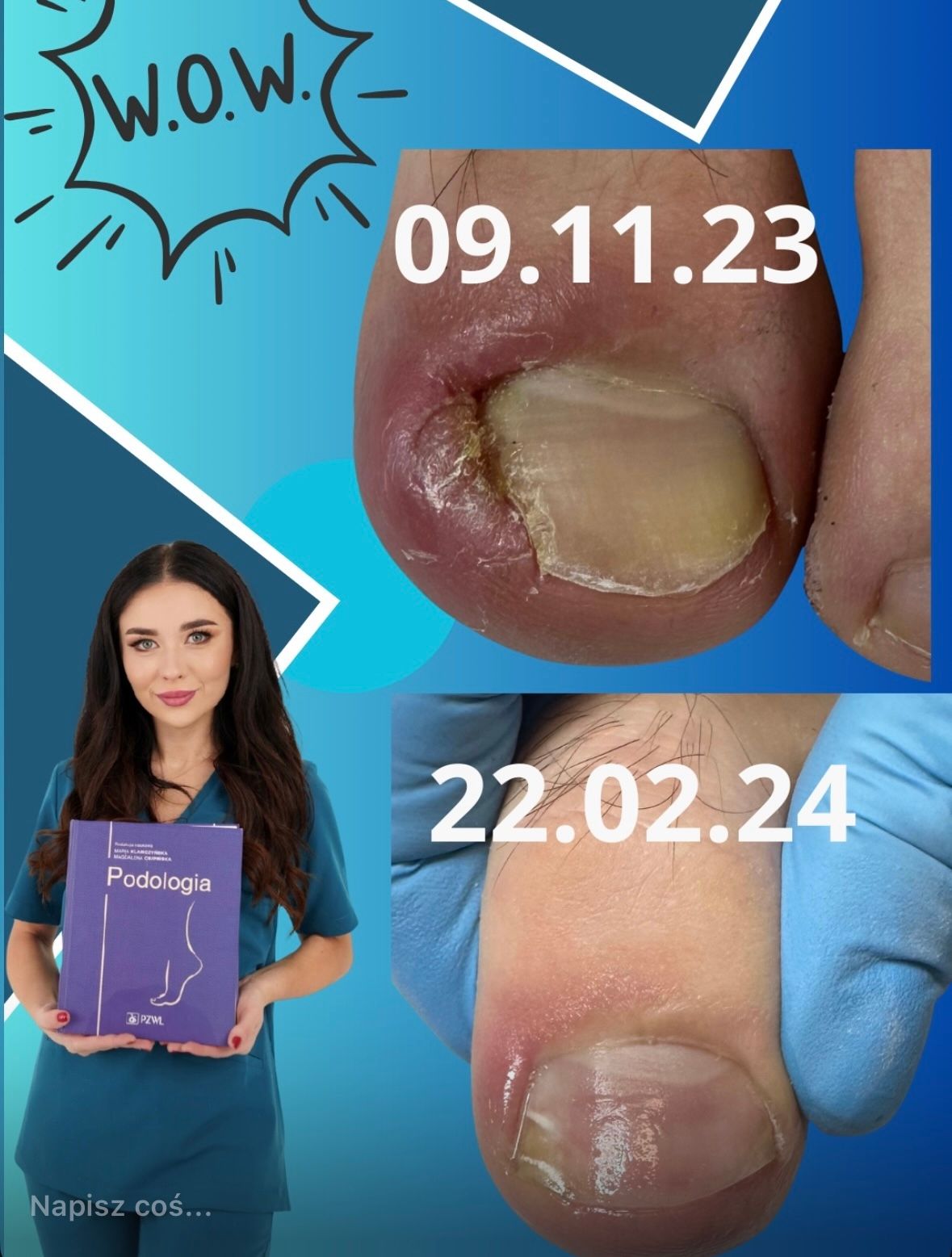 Karolina Colonna-Walewska-21