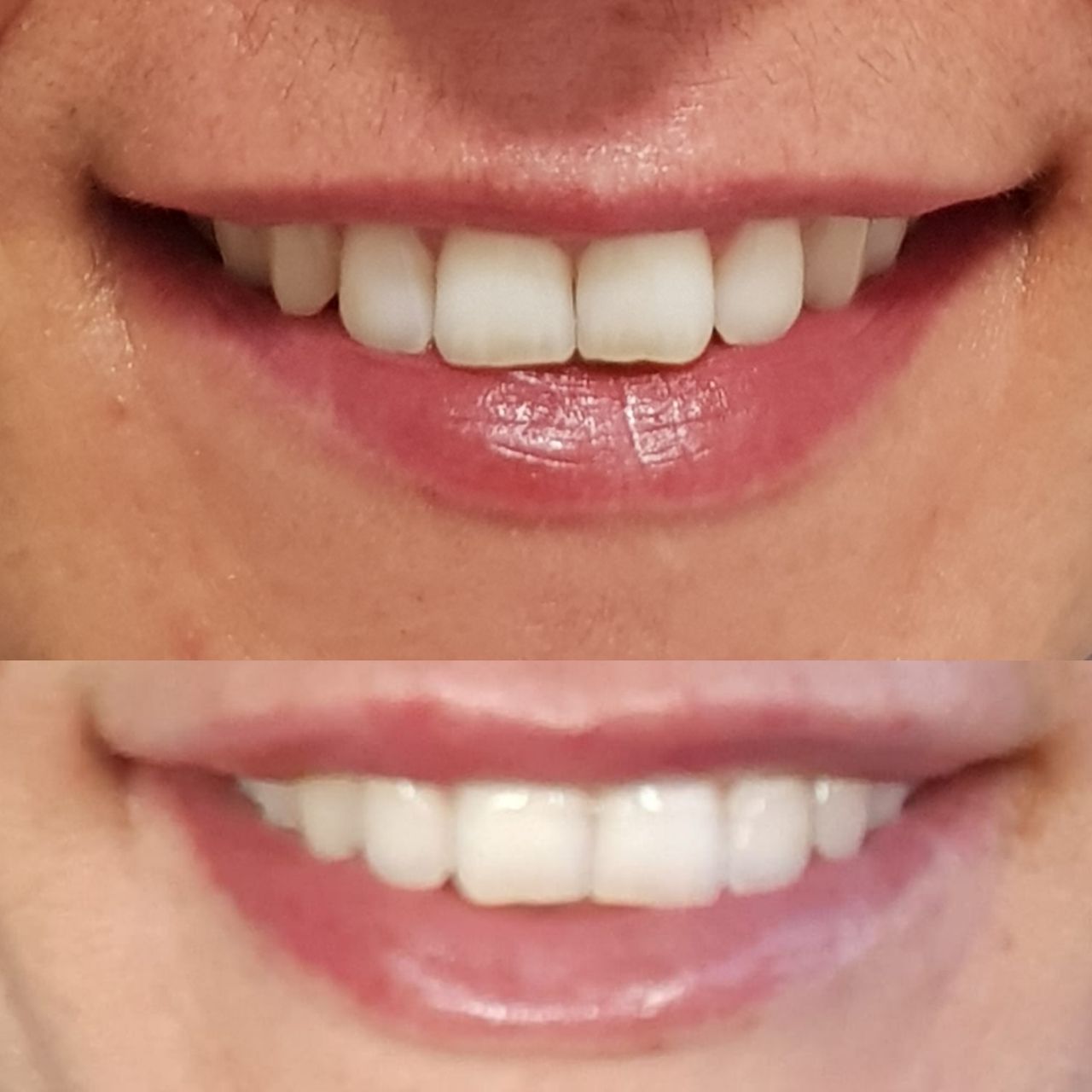 Rosalba Herrero Zerpa-278