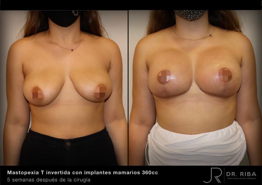 Jordi Riba Vilchez-49