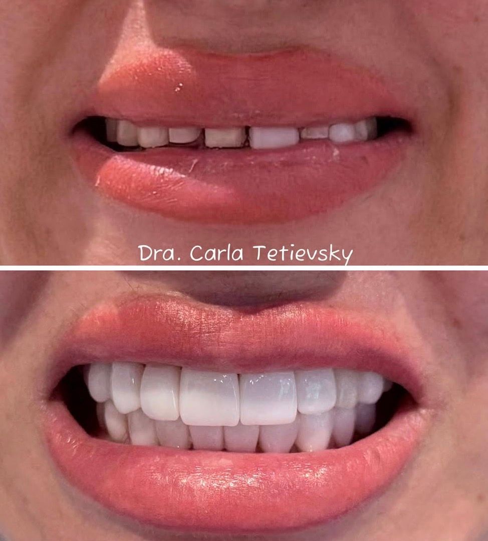 Carla Tetievsky-18