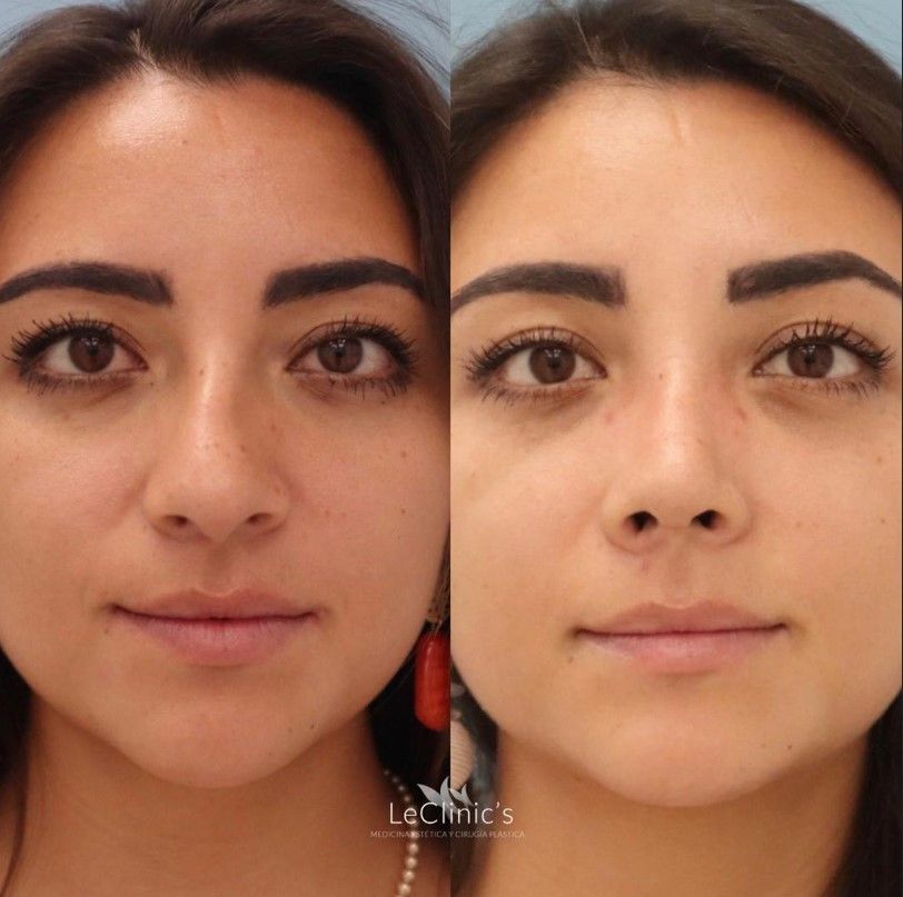 Carlos Corrales Benítez-3