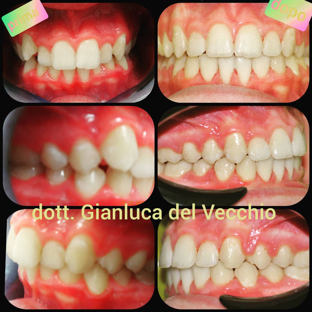 Gianluca Del Vecchio-31