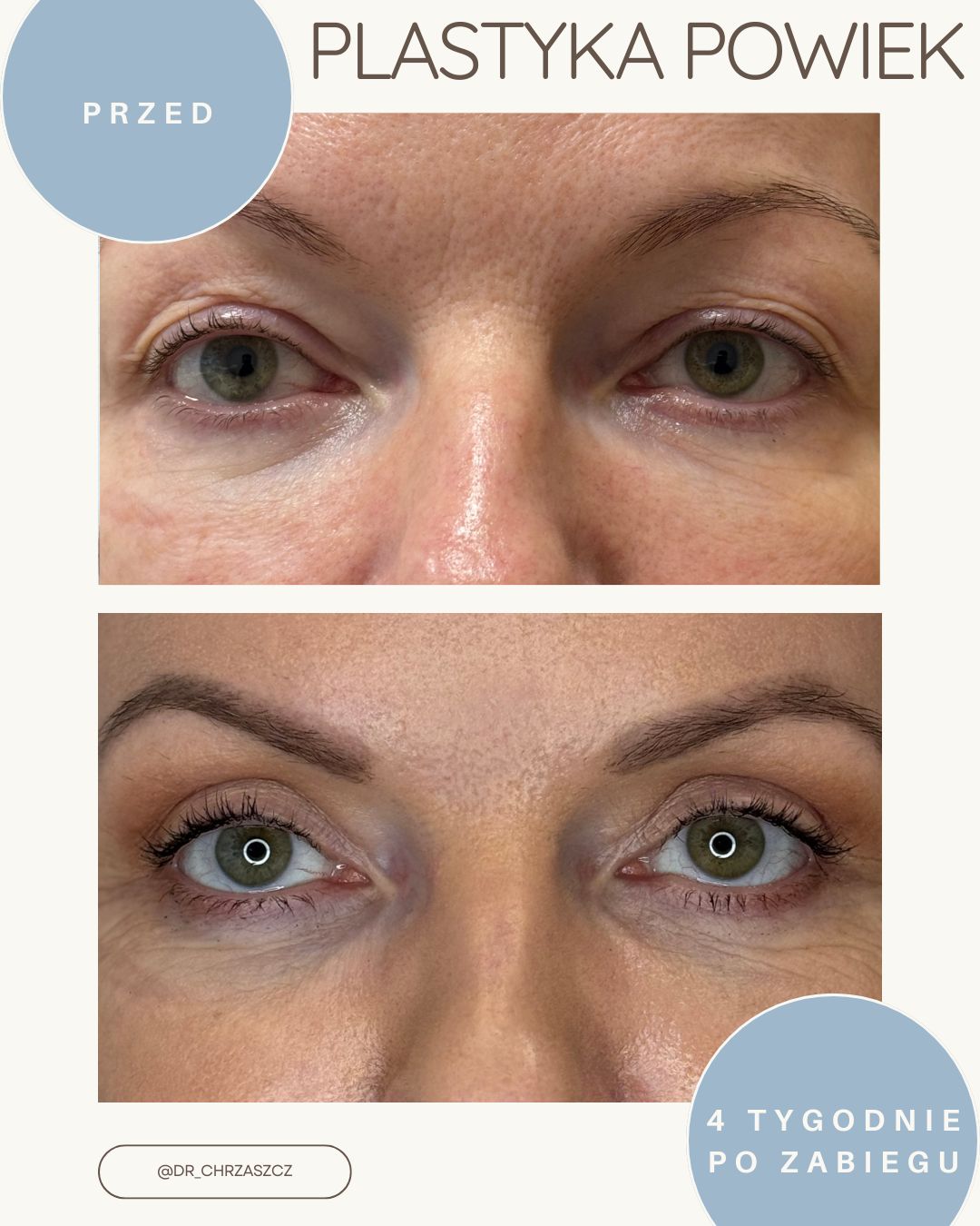 Michał Chrząszcz-2