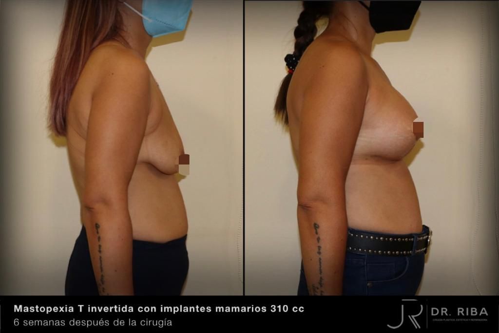 Jordi Riba Vilchez-44