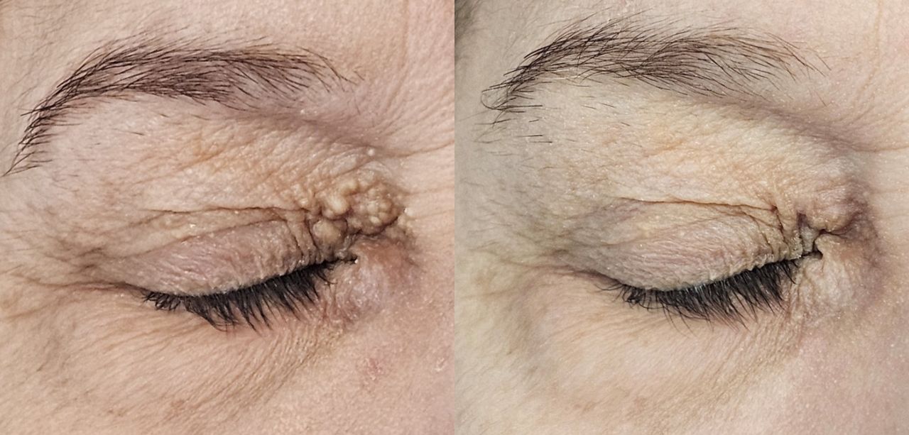 Rosalba Herrero Zerpa-41